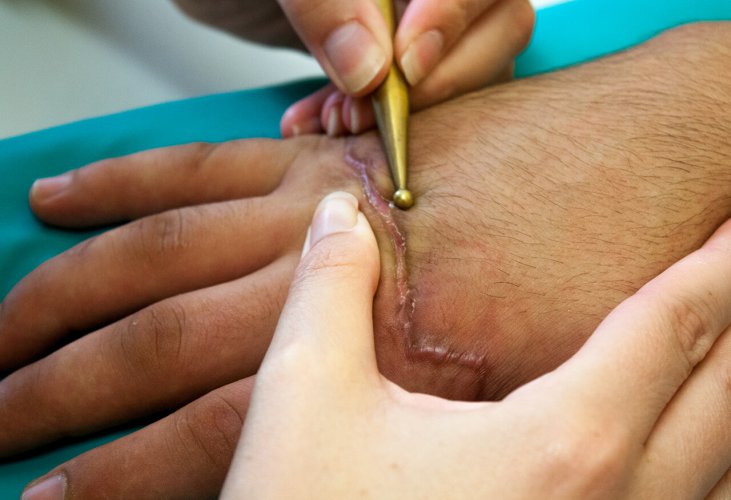 narbentherapie4_ergotherapie-holzkirchen-unterhaching